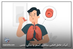 کپک عامل اصلی بیماری آسم یا تنگی نفس